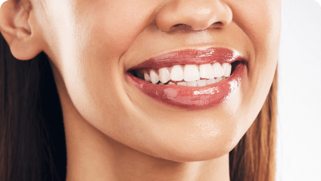 A woman displays a joyful smile, highlighting her stunning white teeth and exuding warmth and confidence