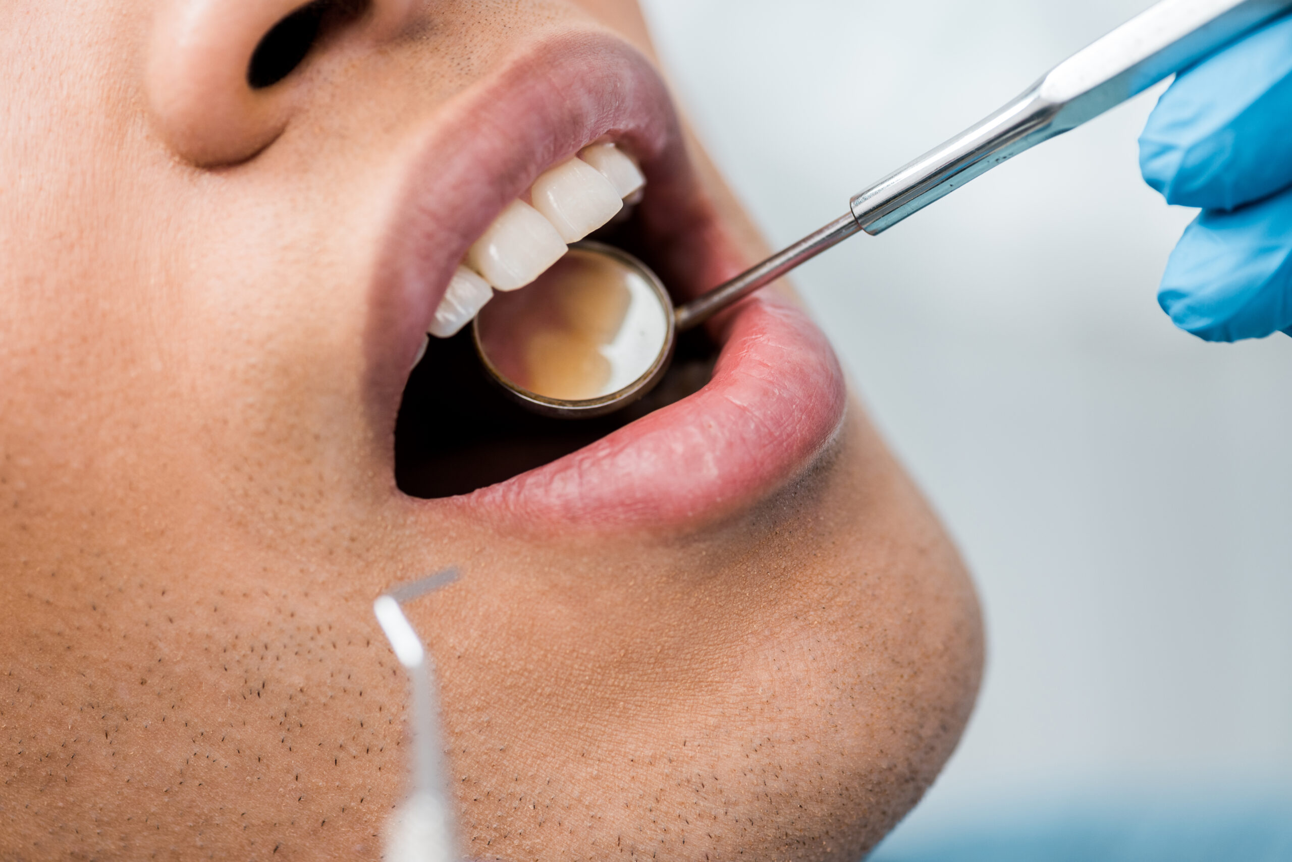 Glenvalley Dental Biomimetic Dental Treatment